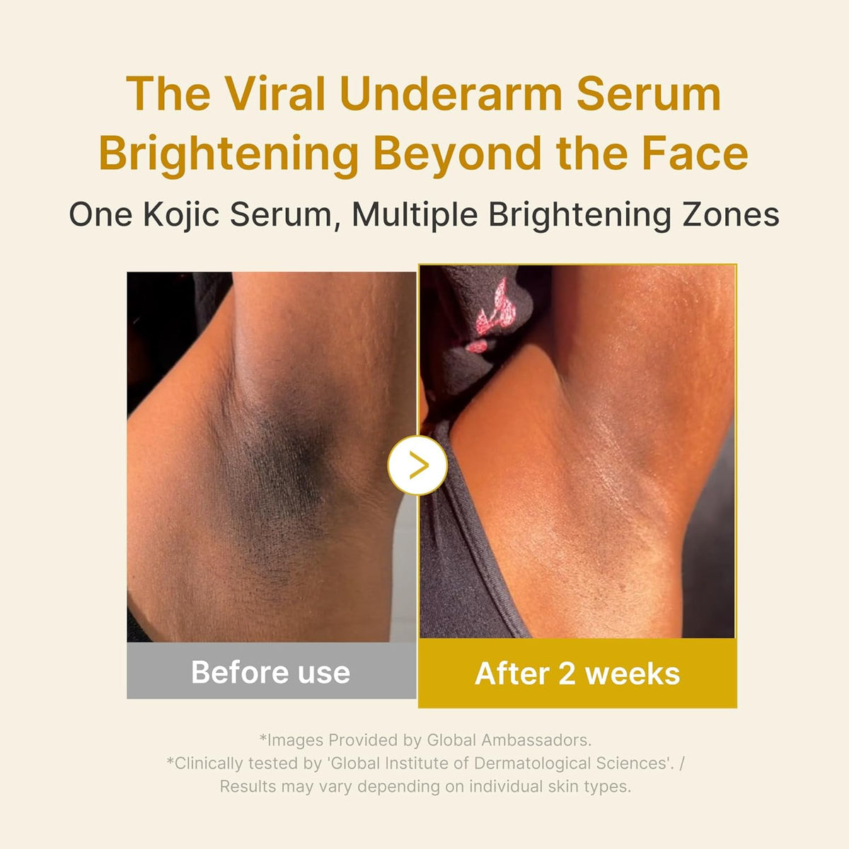 medicube Kojic Acid Turmeric Brightening Serum