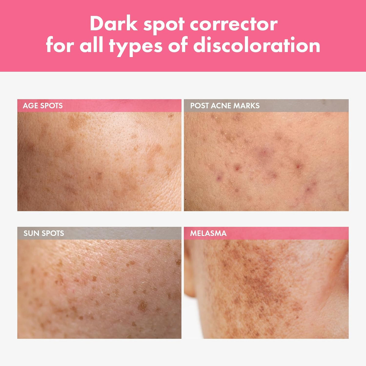 TOSOWOONG Arbutin 7.0 Intensive Spot Cream