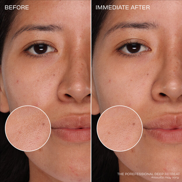 Benefit The Clear Necessities Skincare Kit