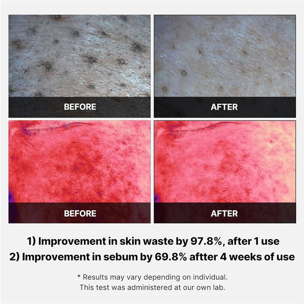 medicube Red Succinic Acid Peeling Pad