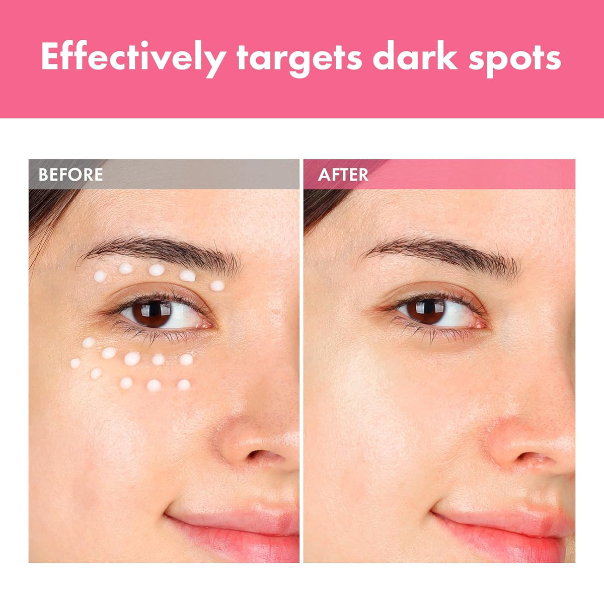 TOSOWOONG Arbutin 7.0 Intensive Spot Cream