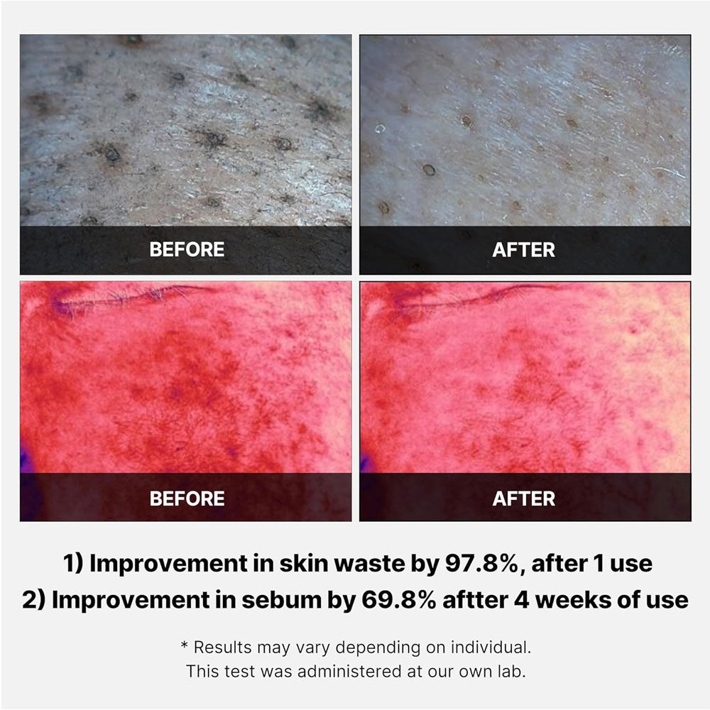 medicube Red Succinic Acid Peeling Pad