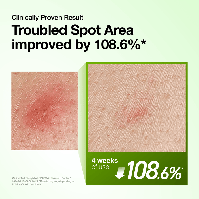 ANUA Azelaic Acid 10% and Hyaluronic Serum