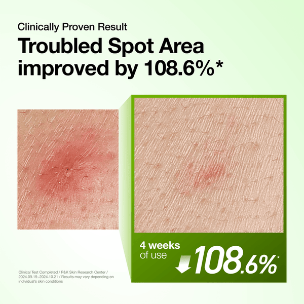 ANUA Azelaic Acid 10% and Hyaluronic Serum